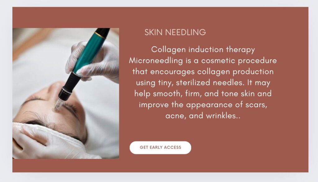 skin needling 2